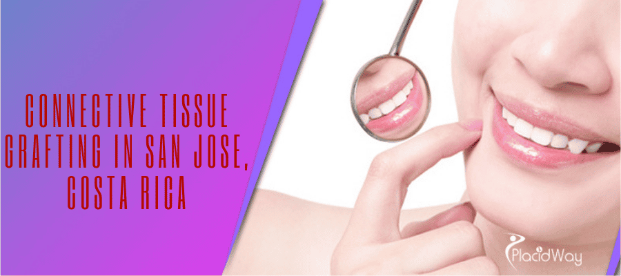 Connective Tissue Grafting in San Jose, Costa Rica